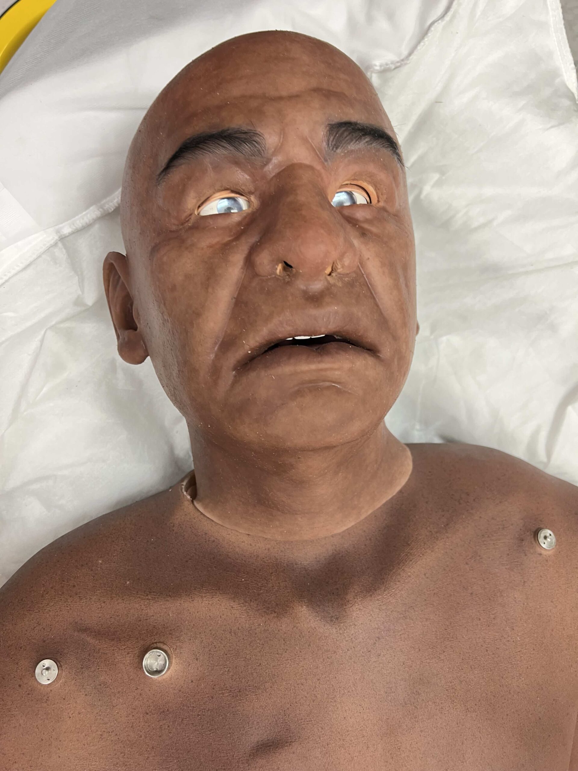 Echo Healthcare's highly realistic SecondSkin simulation product