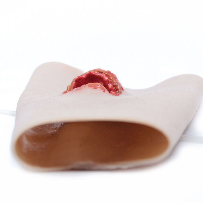 Echo Healthcare's TraumaSim TraumaWear Forearm Open Fracture with bleeding capabilities