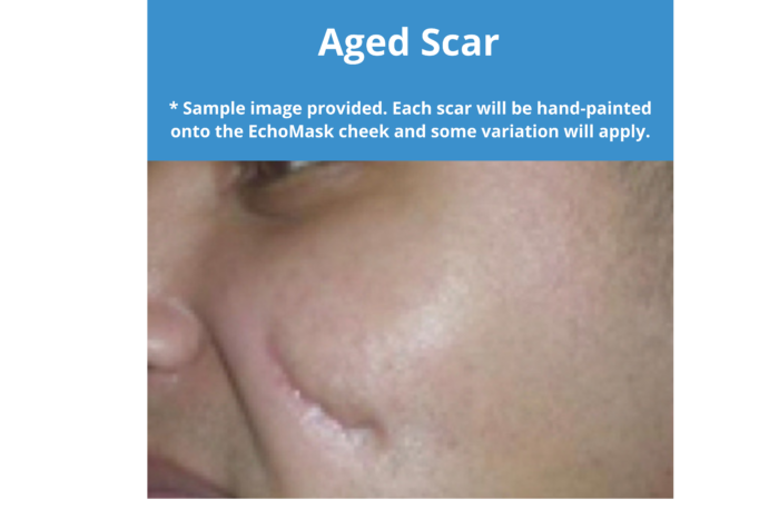 EchoMask Aged Scar option from Echo Healthcare