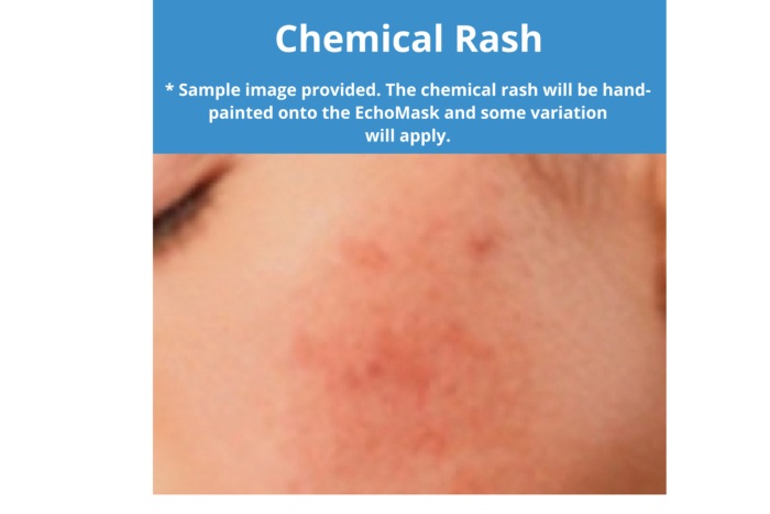 EchoMask Chemical Rash option from Echo Healthcare