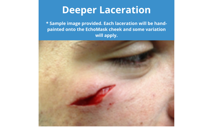 EchoMask Deeper Laceration option from Echo Healthcare