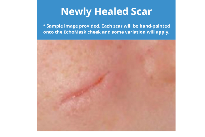 EchoMask Newly Healed Scar option from Echo Healthcare