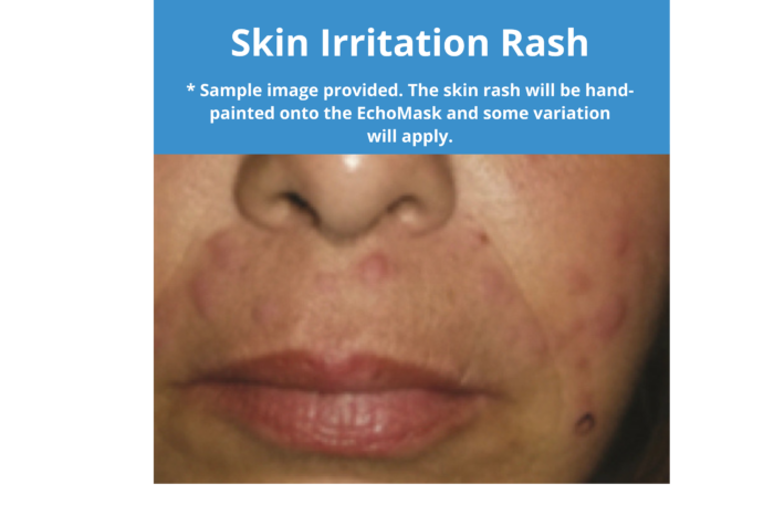 EchoMask Skin Irritation Rash option from Echo Healthcare
