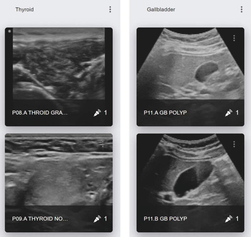 e Sono Ultrasound Training – Echo Healthcare