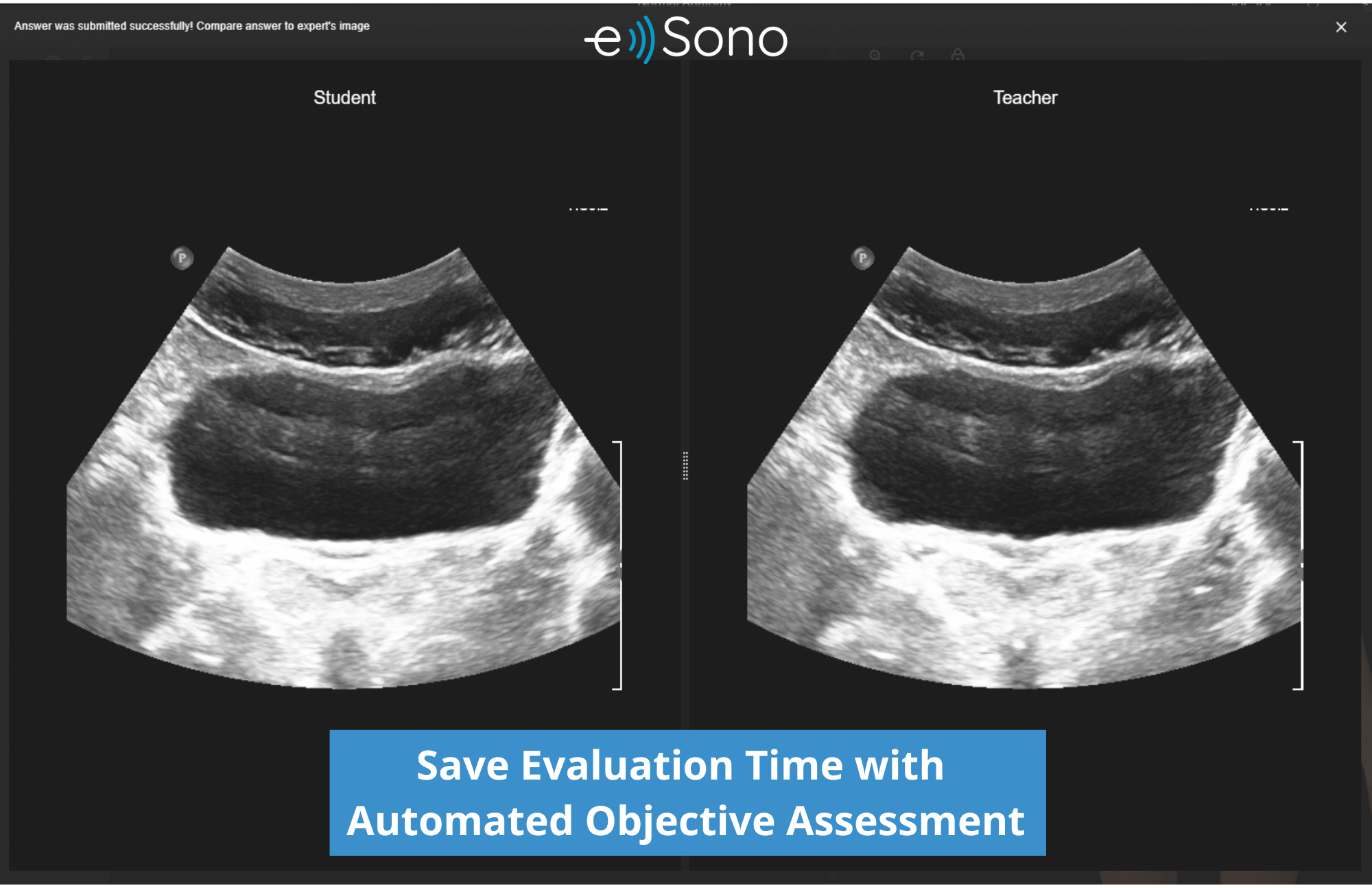 e Sono ultrasound simulation provided by Echo Healthcare