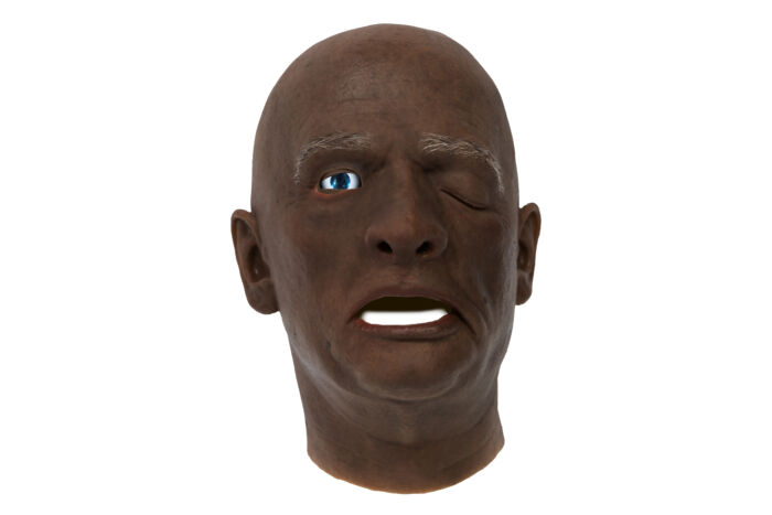 EchoMask Male Stroke patient in dark skin tone